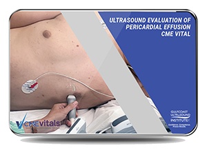 Ultrasound Evaluation of Pericardial Effusion